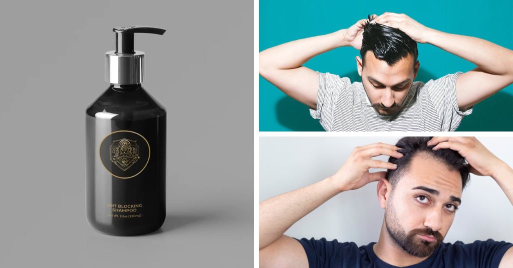 Best Shampoo For Men Thinning Hair