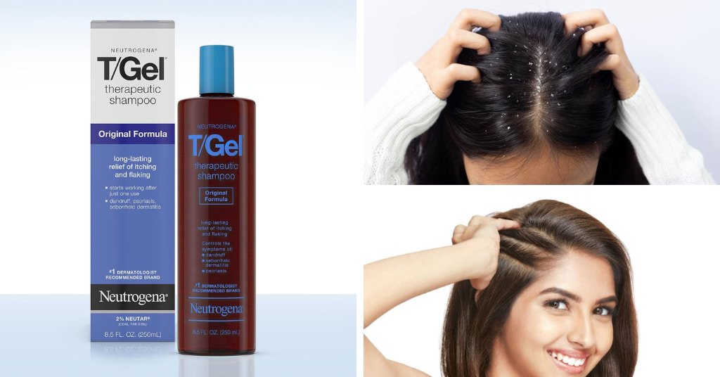Best Anti Dandruff Shampoo