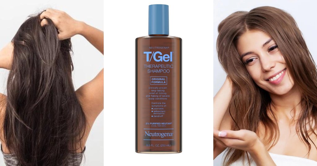 Shampoo for Dry Scalp