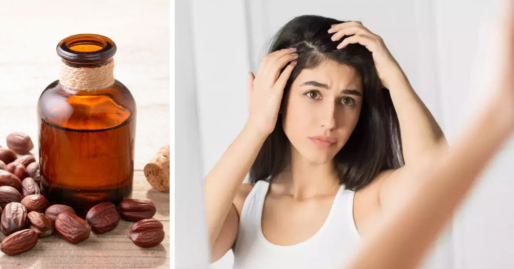 Hair Oil For Dandruff