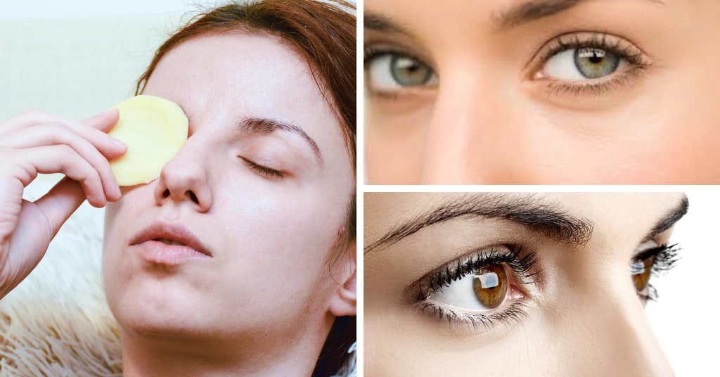 20 Natural Under Eye Care Tips for Healthier Eyes
