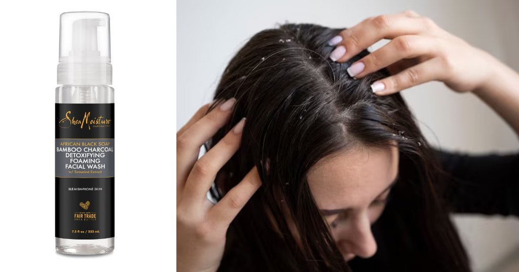 Best Anti Dandruff Shampoo