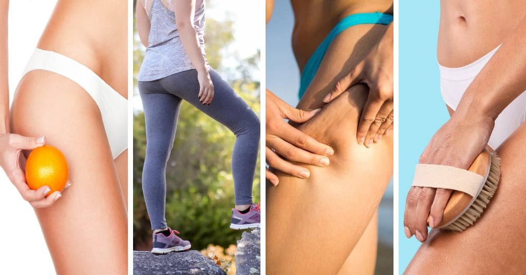 Best 10 Ways How To Camouflage Cellulite On Legs