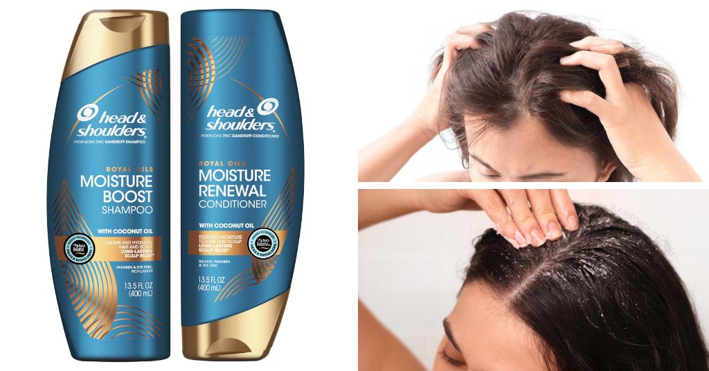 Shampoo for Dry Scalp