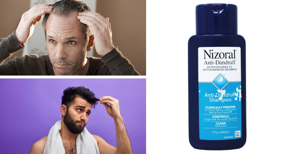 Best Shampoo For Men Thinning Hair