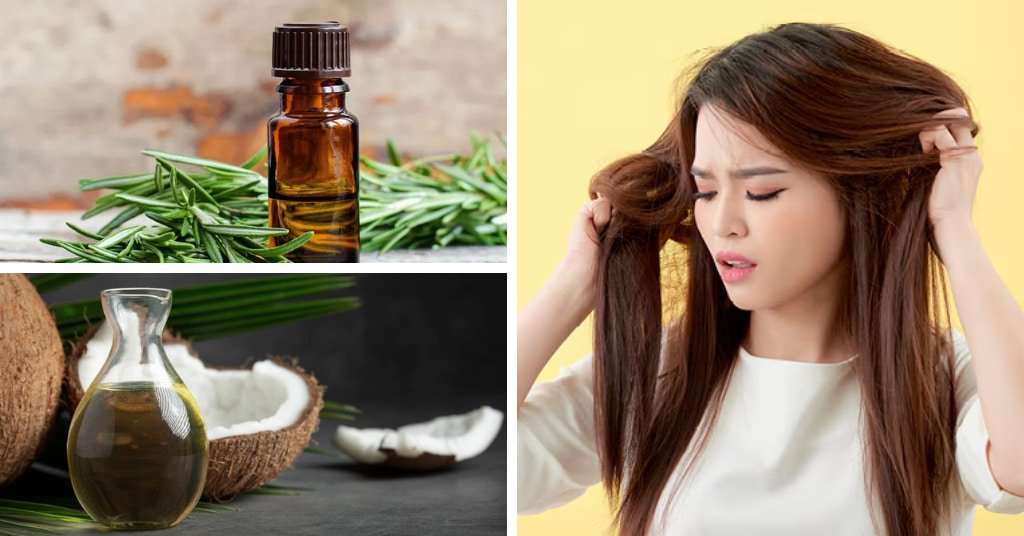 Hair Oil For Dandruff