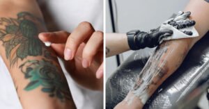 Best 10 Tattoo Numbing Creams to remove your tattoo