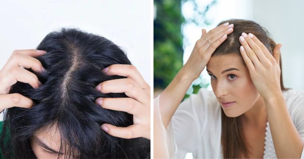 Shampoo for Dry Scalp