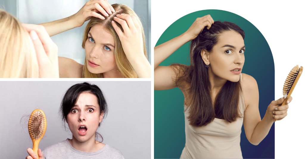 Best Shampoos for Female Hair Loss