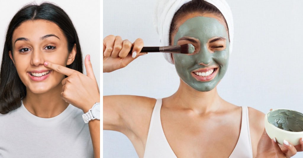 Best Way To Remove Blackheads