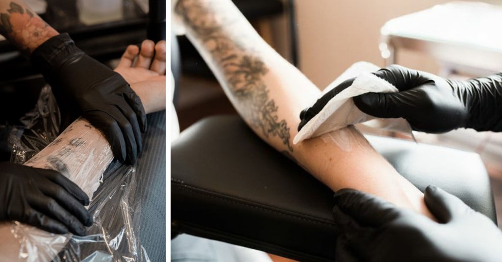 Best 10 Tattoo Numbing Creams to remove your tattoo