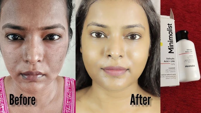 Minimalist 2% Salicylic Acid + LHA Cleanser
